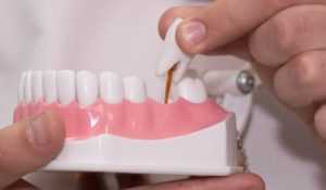 Чем занимается стоматолог-ортопед?
