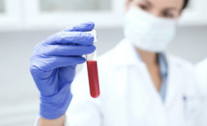 Анализ крови. Клиническая лаборатория